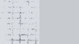 Wunder Under Crop High-Rise *Scallop