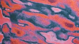 Wunder Train HR Tight 25"