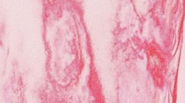 New Blush Blend/Pink Pearl/White/Mulberry Spark